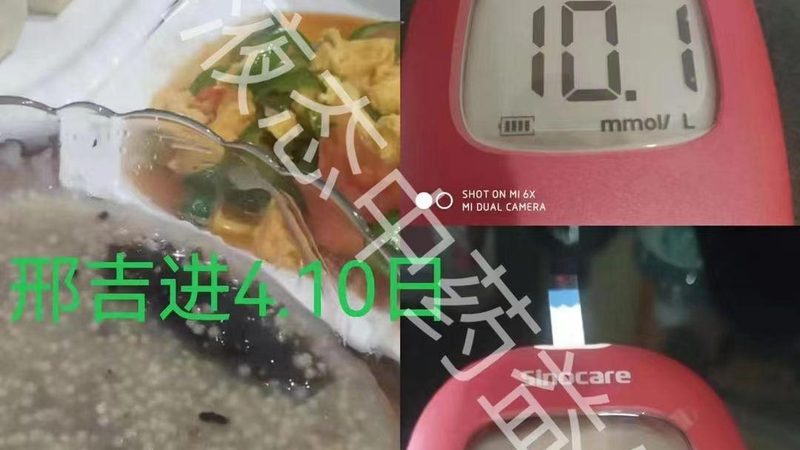 维生素A中毒慢性症状：警惕长期摄入过量
